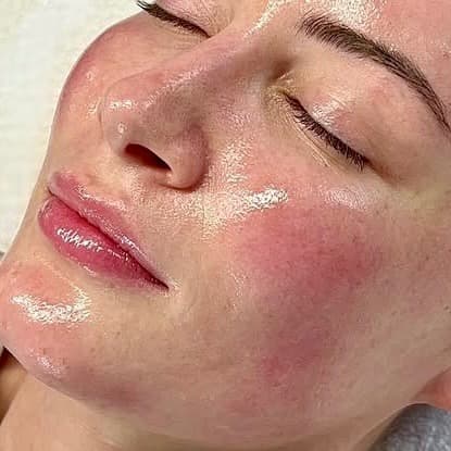 Million Dollar Facial - Miracle Mask