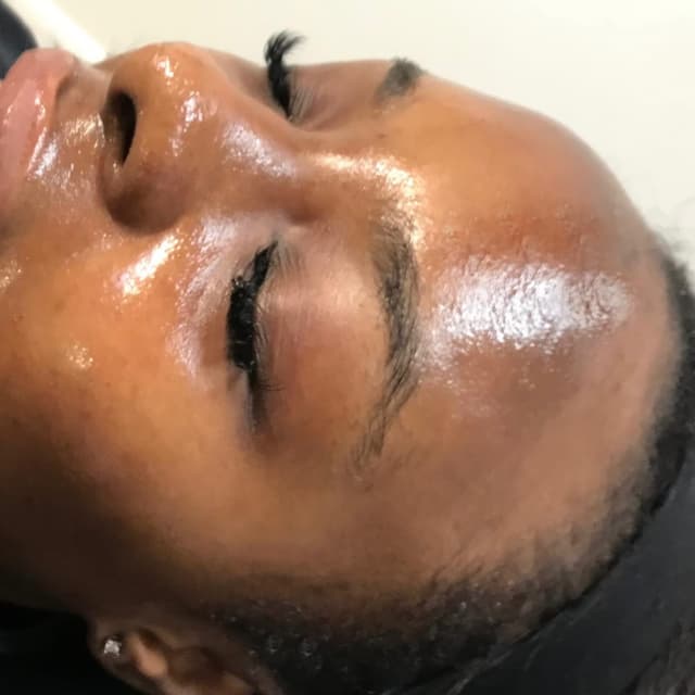 Million Dollar Facial - Dermaplaning Skin Glow