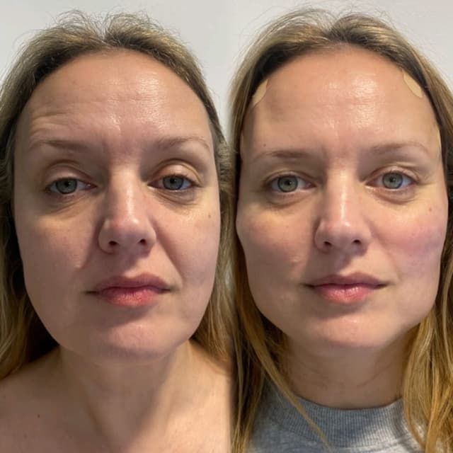 PDO Threads - Full Facelift