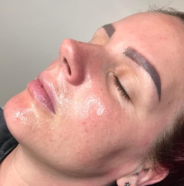 Million Dollar Facial - Miracle Mask