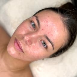 Signature Glow Facial