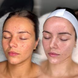 3 Month Transformation