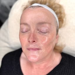 Dermaplaning & HydroFacial