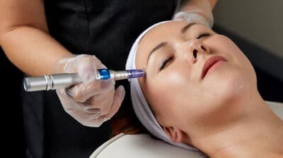 Micro Needling