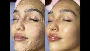 Contour Facial Mask