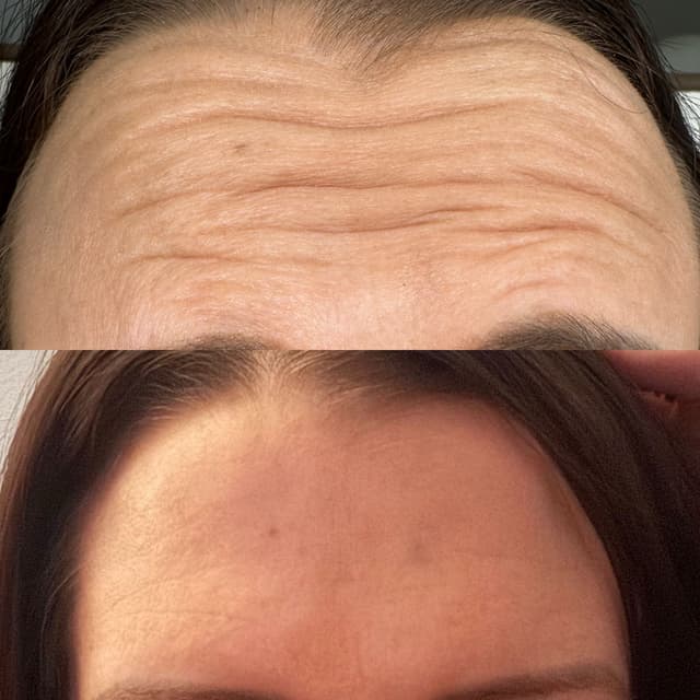 Anti wrinkle