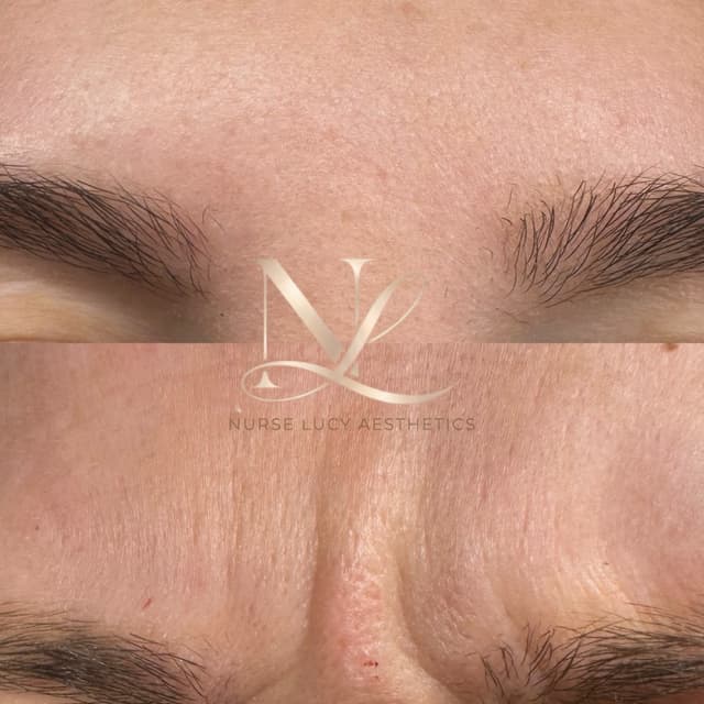 Anti wrinkle