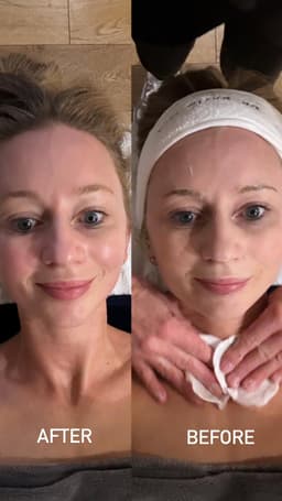 Dr David Jack Lift & Sculpt