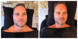 Dr David Jack Lift & Sculpt Facial