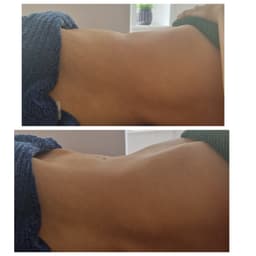 Reduce the bloat with lymphatic drainage