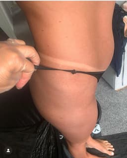 #tanlines