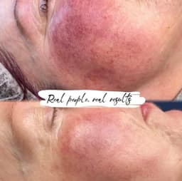 Million dollar results