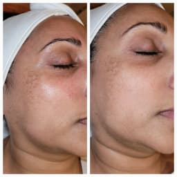 Million Dollar Immaculate Peel