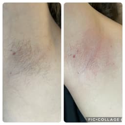 ‘Bye-bye fuzz, hello gorgeous’