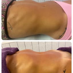 Lymphatic drainage massage