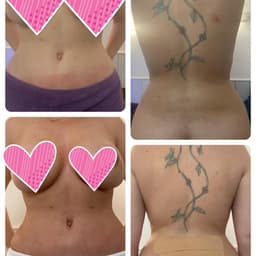 Post surgery massage