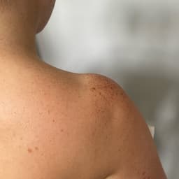 After using 6% light tan on fair skin