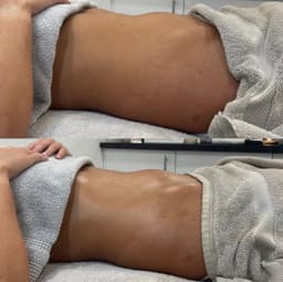 Lymphatic drainage Massage (90 Mins) | £95 - 100 Minutes