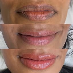 Lip neautrilisation