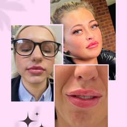 Lips