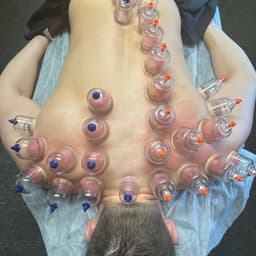 Sports Massage + Cupping