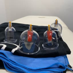 Cupping treatment