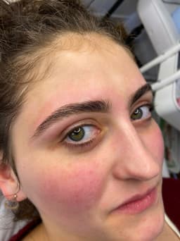 Brow defenition