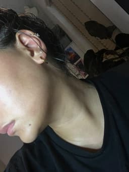 Client selfie 24hrs after v-line lemon bottle