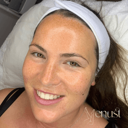 The PureCleanse  is the perfect facial to remove debris from pores, impurities and dead skin cells while buffing the skin leaving it cleansed, plumped and smooth.