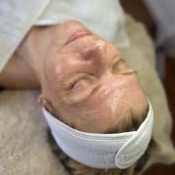 Results from a DMK nutritional facial usin Pro Alpha #1