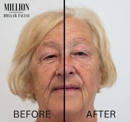Million Dollar Miracle Mask