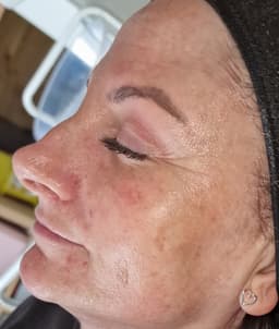 Million Dollari mini facial
