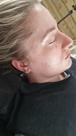 Million Dollar mini facial