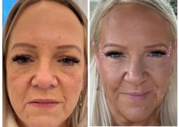 Dermaqual 24 point non surgical face-lift