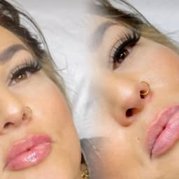 Lip filler