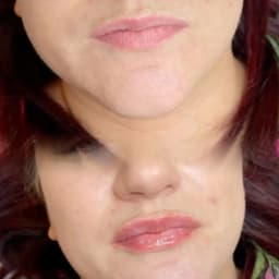 Lip filler