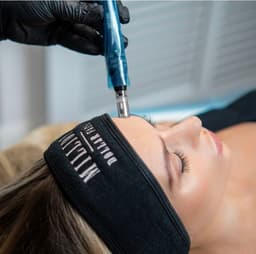 Microneedling Facials