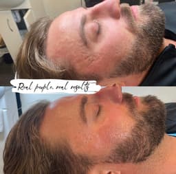 Facials for Men