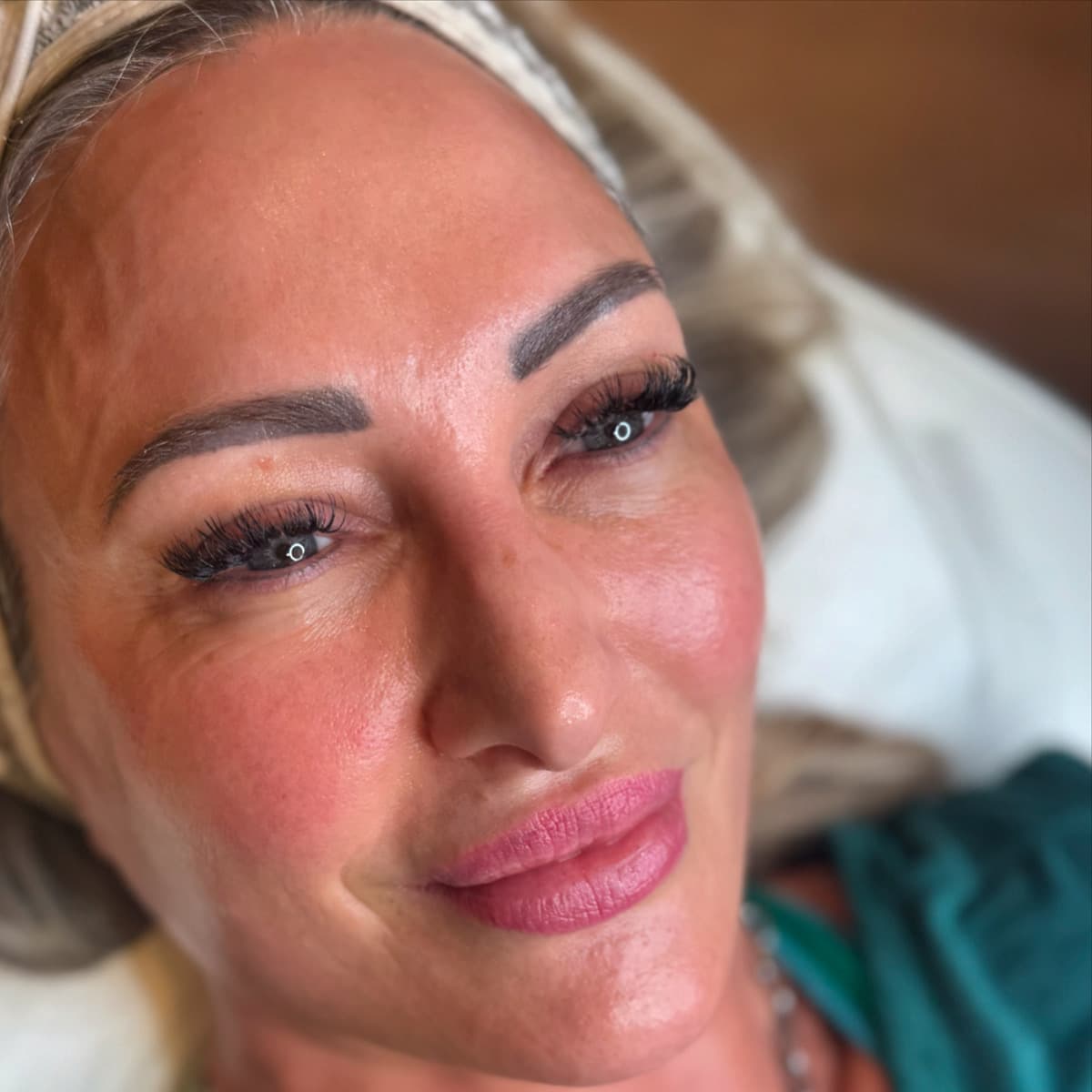 Nimue Active Rejuvenation peel