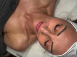 Active rejuvenation peel