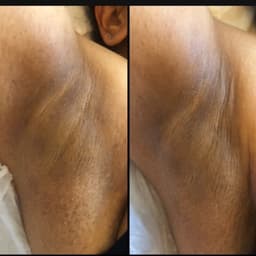 Before (right) After (Left)