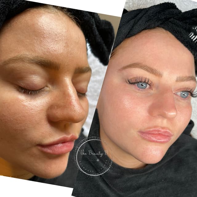 Miracle Mask with Stream and extractions and Classic lashes