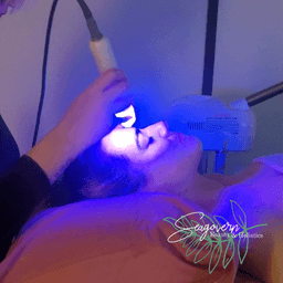 Microdermabraision Facial