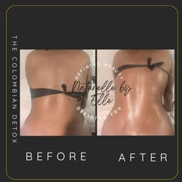 Manual Lymphatic Drainage