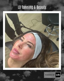 Gorgeous client following her Dermaplaning & Microneedling treatment