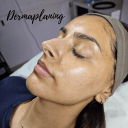 Dermaplaning