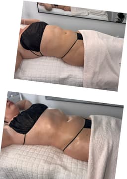 Confidence starts here — professional body contouring treatments in Chelmsford designed for you.
