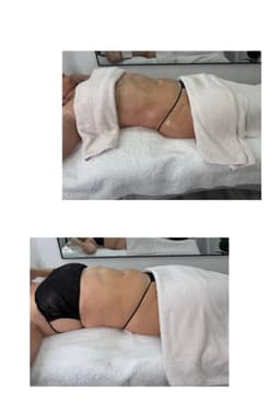 Burn fat and build muscle with cutting-edge EMS Body Contouring at Kehs Beauty Studio.