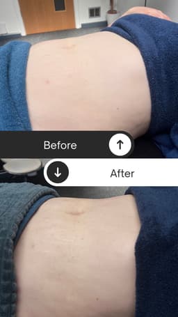 Brazilian lymphatic drainage Aberlour