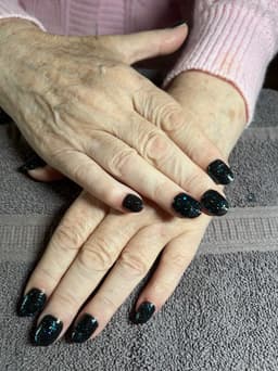 Gel extensions, Rothes